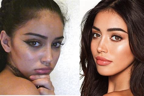 Cindy Kimberly’s Plastic Surgery: Truth About Her。